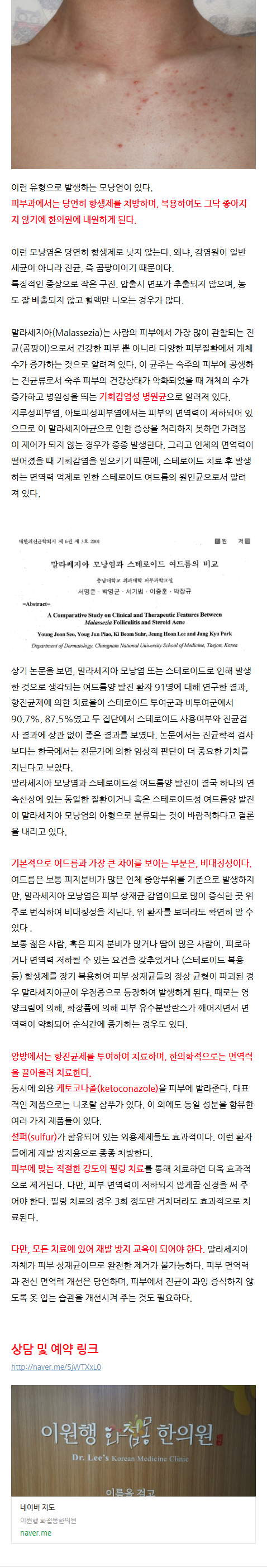 고양한의원 ynilm